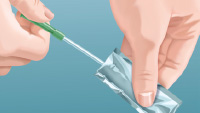 Thumbnail for PDF: Apogee Intermittent Catheter Guide for Use - Male