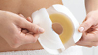 Thumbnail for PDF: Two-Piece Pouching System Care Tips